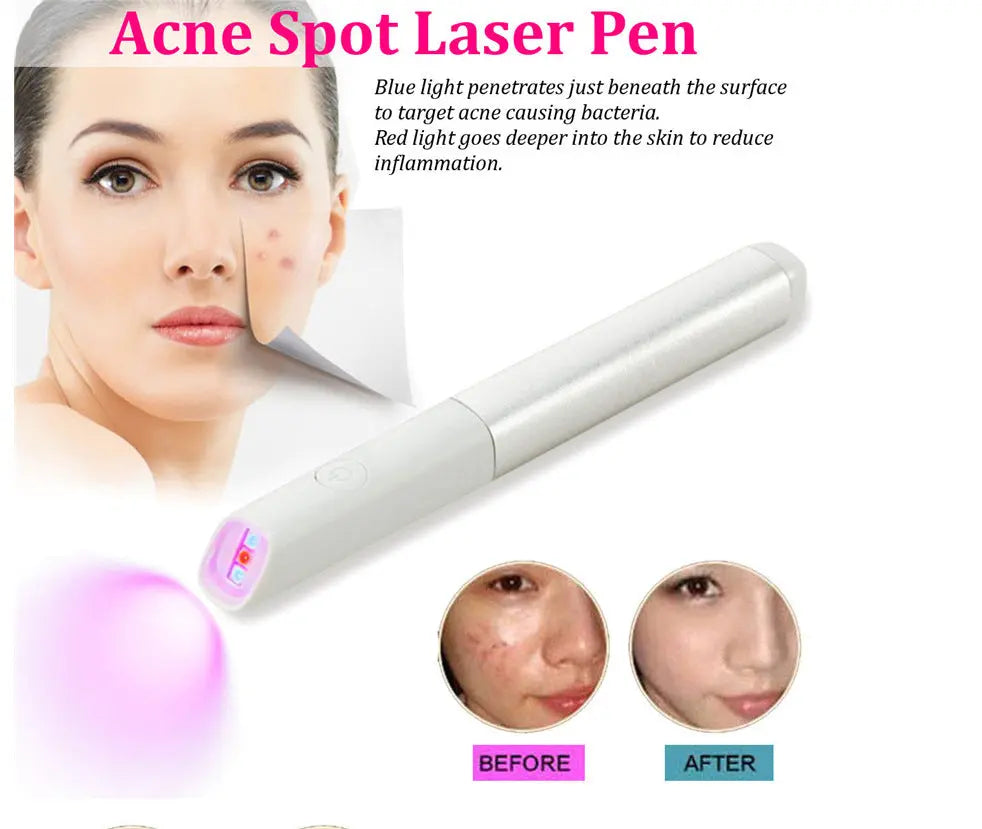 LED Red Blue Light Acne Treatment Pen velquroo