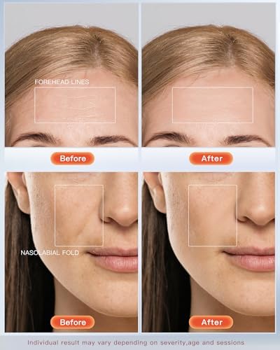 NEWKEY 4D LED Therapy Mask velquroo